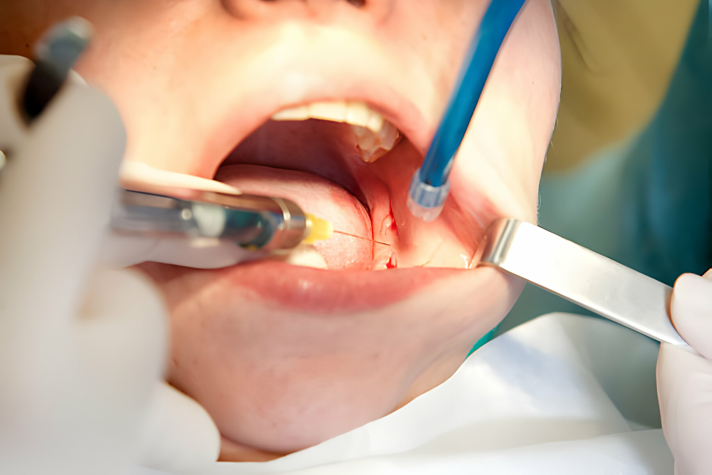 Why Should You Choose Charlotte Dental Esthetics?_3