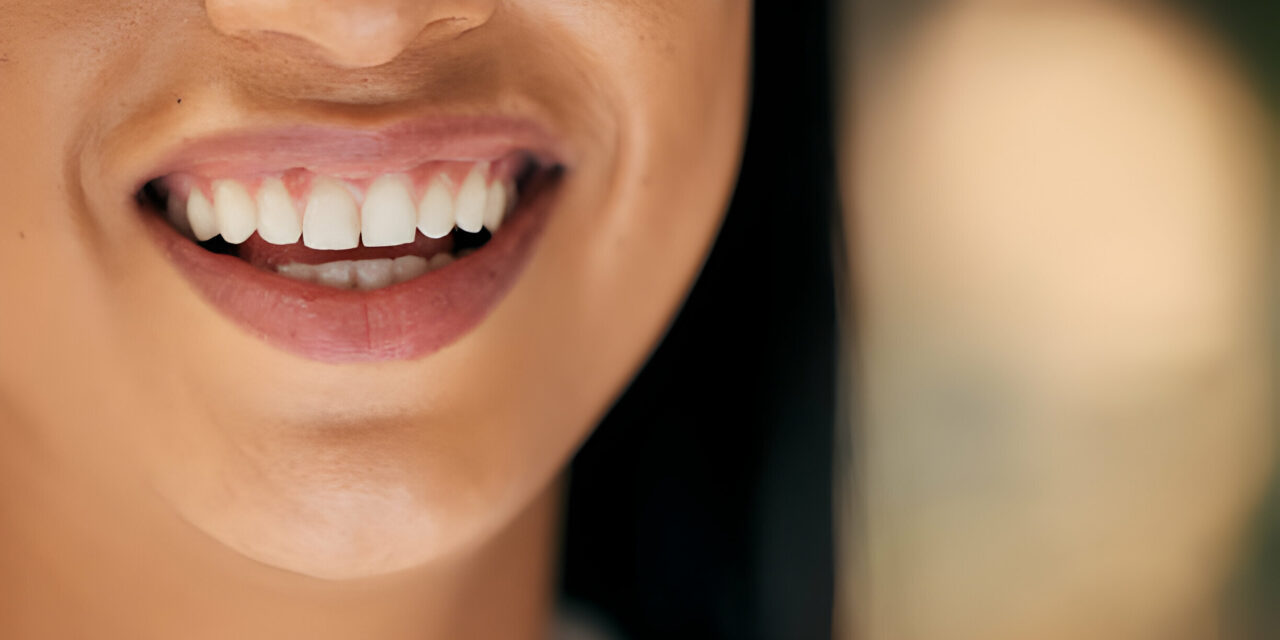 How To Maintain Your Bright Smile: Post-Whitening Care Tips