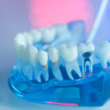 Signs You Might Need a Root Canal and What to Do Next_FI