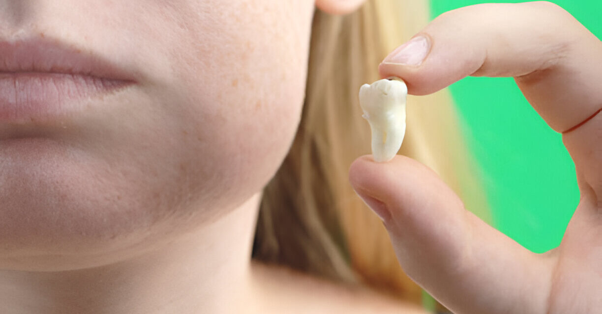 The Benefits of Tooth Extractions for Oral Health