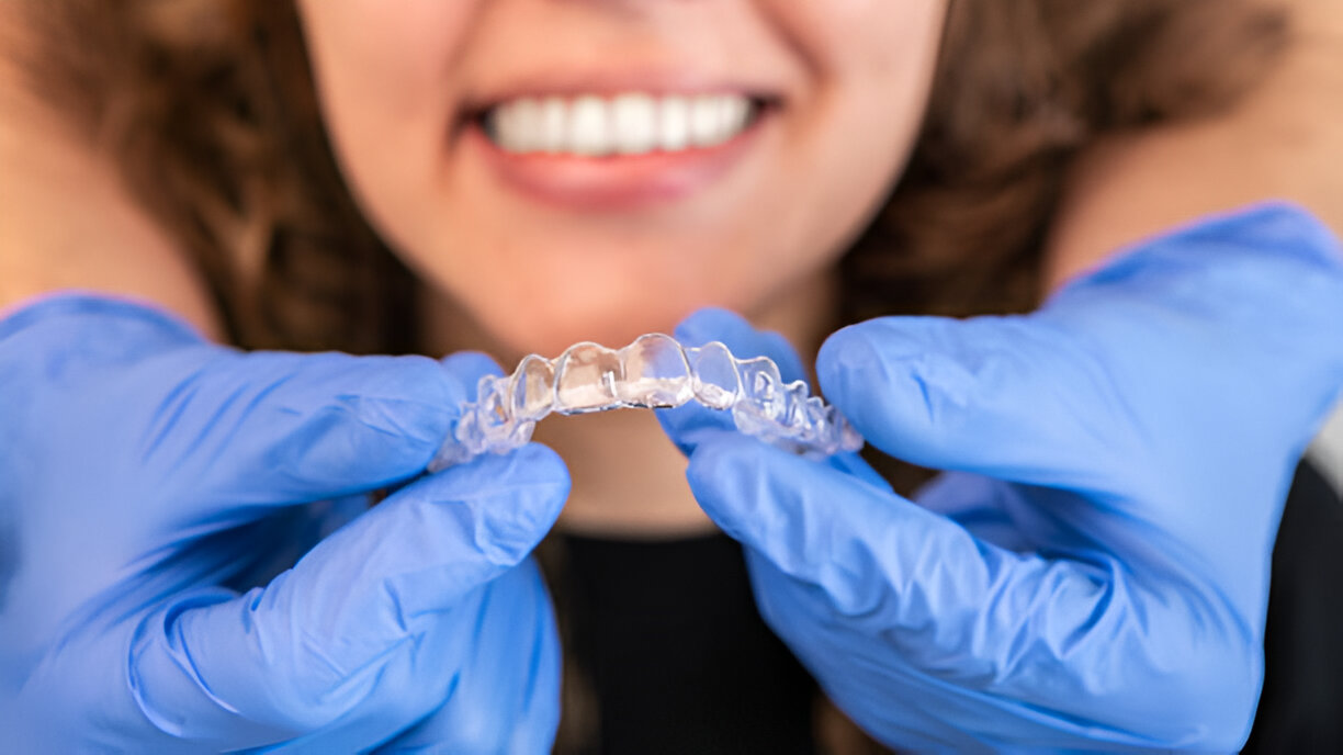 Invisalign at Smile Charlotte: What Charlotte, NC Dentists Recommend for a Straighter Smile_1